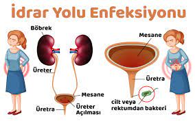 İdrar Yolu Enfeksiyonuna Ne İyi Gelir? 14 Bitkisel Bilgi