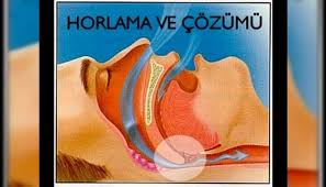Horlamanın Çözümü Var Mı, Horlama Tedavisi Nasıl Yapılır?