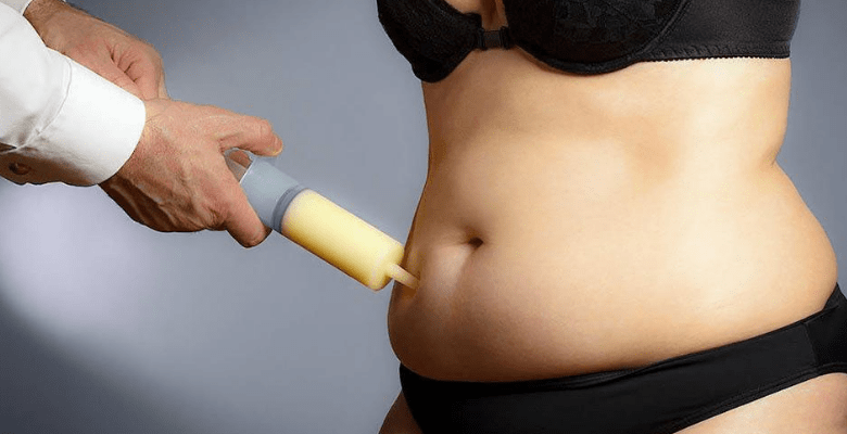 Liposuction